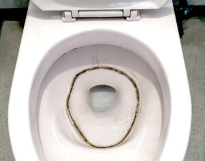 トイレの水がたまるところの頑固な黒カビ汚れの取り方